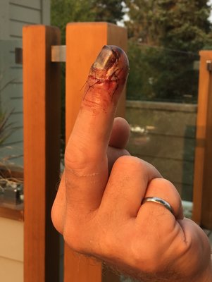 zombie finger.jpg